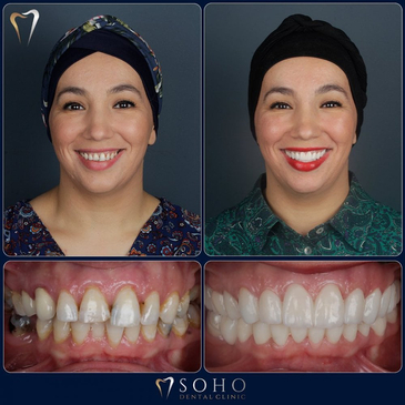 Slider image (3) Soho Dental Clinic